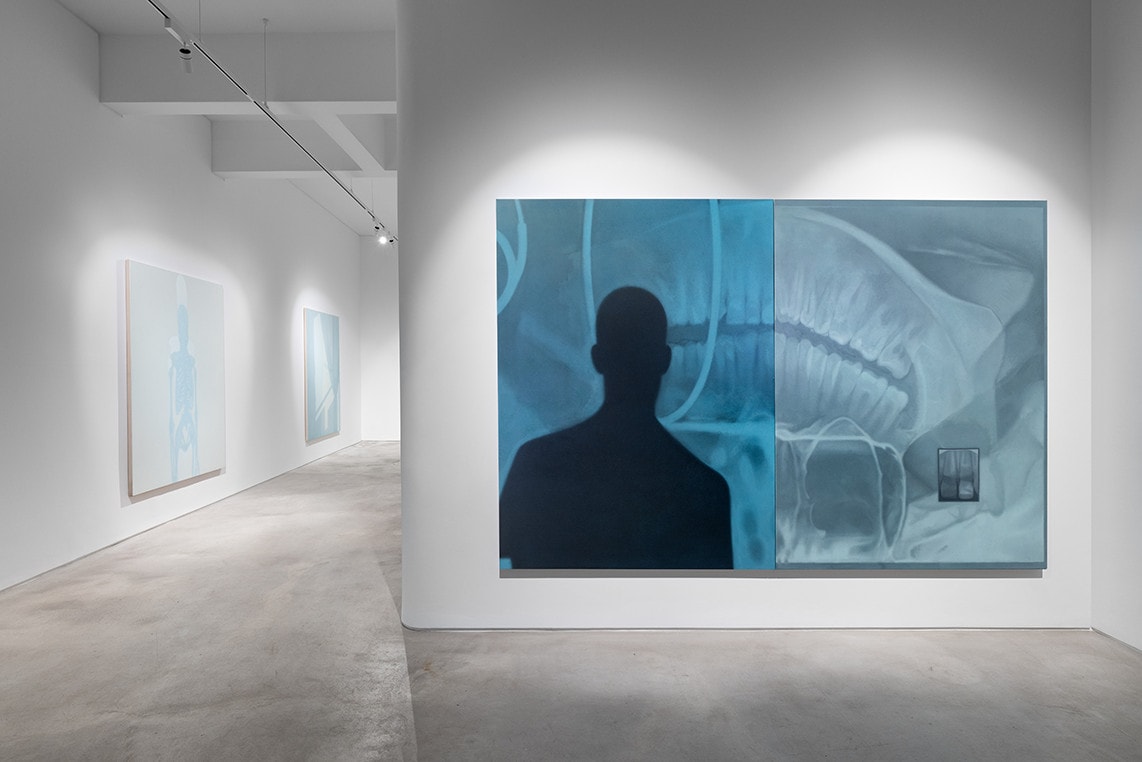 Gonçalo Preto: under the light of a slow-burning blue flame